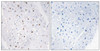Immunohistochemical analysis of paraffin-embedded human heart tissue, using Bloom Syndrome Protein (Phospho-Thr99) antibody (left) or the same antibody preincubated with blocking peptide (right) .