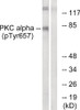 Western blot analysis of extracts from COLO205 cells using PKC alpha (Phospho-Tyr658) Antibody. The lane on the right is treated with the antigen-specific peptide.