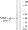 Western blot analysis of extracts from HUVEC cells treated with UV using C/EBP-ε (Phospho-Thr74) Antibody. The lane on the right is treated with the antigen-specific peptide.