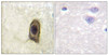 Immunohistochemical analysis of paraffin-embedded human brain, using CSFR (Phospho-Tyr561) antibody (left) or the same antibody preincubated with blocking peptide (right) .