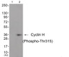 Western blot analysis of extracts from JK cells (Lane 2) , using Cyclin H (Phospho-Thr315) Antibody. The lane on the left is treated with antigen-specific peptide.