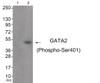 Western blot analysis of extracts from JK cells (Lane 2) , using GATA2 (Phospho-Ser401) Antibody. The lane on the left is treated with antigen-specific peptide.