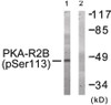 Western blot analysis of extracts from COS-7 cells treated with PMA using PKA-R2beta (Phospho-Ser113) Antibody. The lane on the right is treated with the antigen-specific peptide.