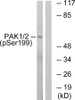 Western blot analysis of extracts from LOVO cells treated with starved using PAK1/2 (Phospho-Ser199) Antibody. The lane on the right is treated with the antigen-specific peptide.