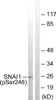 Western blot analysis of extracts from HT29 cells using SNAI1 (Phospho-Ser246) Antibody. The lane on the right is treated with the antigen-specific peptide.