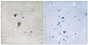 Immunohistochemical analysis of paraffin-embedded human brain tissue using HSF1 (Phospho-Thr142) antibody (left) or the same antibody preincubated with blocking peptide (right) .