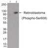 Western blot analysis of extracts from JK cells (Lane 2) , using Retinoblastoma (Phospho-Ser608) Antibody. The lane on the left is treated with antigen-specific peptide.