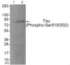 Western blot analysis of extracts from JK cells (Lane 2) , using Tau (Phospho-Ser519/202) Antibody. The lane on the left is treated with antigen-specific peptide.