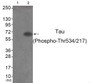 Western blot analysis of extracts from HepG2 cells (Lane 2) , using Tau (Phospho-Thr534/217) Antibody. The lane on the left is treated with antigen-specific peptide.