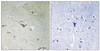 Immunohistochemical analysis of paraffin-embedded human brain tissue, using ALK (Phospho-Tyr1096) antibody (left) or the same antibody preincubated with blocking peptide (right) .