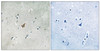 Immunohistochemical analysis of paraffin-embedded human brain tissue using EPHA3/4/5 (Phospho-Tyr779/833) antibody (left) or the same antibody preincubated with blocking peptide (right) .