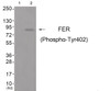 Western blot analysis of extracts from JK cells (Lane 2) and COS7 cells (Lane 3) , using FER (Phospho-Tyr402) Antibody. The lane on the left is treated with antigen-specific peptide.