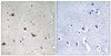 Immunohistochemical analysis of paraffin-embedded human brain tissue using IKK-γ (Phospho-Ser376) antibody (left) or the same antibody preincubated with blocking peptide (right) .