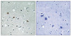 Immunohistochemical analysis of paraffin-embedded human brain tissue using LATS1/2 (Phospho-Thr1079/1041) antibody (left) or the same antibody preincubated with blocking peptide (right) .