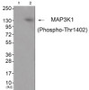 Western blot analysis of extracts from JK cells (Lane 2) , using MAP3K1 (Phospho-Thr1402) Antibody. The lane on the left is treated with antigen-specific peptide.