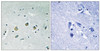 Immunohistochemical analysis of paraffin-embedded human brain tissue using MAP3K8 (Phospho-Ser400) antibody (left) or the same antibody preincubated with blocking peptide (right) .