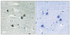 Immunohistochemical analysis of paraffin-embedded human brain tissue using MER/SKY (Phospho-Tyr749/681) antibody (left) or the same antibody preincubated with blocking peptide (right) .