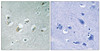 Immunohistochemical analysis of paraffin-embedded human brain tissue using MLK1/2 (Phospho-Thr312/266) antibody (left) or the same antibody preincubated with blocking peptide (right) .