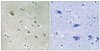 Immunohistochemical analysis of paraffin-embedded human brain tissue using PAK1 (Phospho-Ser204) antibody (left) or the same antibody preincubated with blocking peptide (right) .