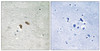 Immunohistochemical analysis of paraffin-embedded human brain tissue using C-RAF (Phospho-Thr269) antibody (left) or the same antibody preincubated with blocking peptide (right) .