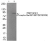 Western blot analysis of extracts from HepG2 cells (Lane 2) , using RSK1/2/3/4 (Phospho-Ser221/227/218/232) Antibody. The lane on the left is treated with antigen-specific peptide.