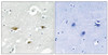 Immunohistochemical analysis of paraffin-embedded human brain tissue using STK39 (Phospho-Ser325) antibody (left) or the same antibody preincubated with blocking peptide (right) .