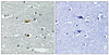 Immunohistochemical analysis of paraffin-embedded human brain tissue using STK39 (Phospho-Ser309) antibody (left) or the same antibody preincubated with blocking peptide (right) .