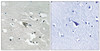 Immunohistochemical analysis of paraffin-embedded human brain tissue using VEGFR1 (Phospho-Tyr1048) antibody (left) or the same antibody preincubated with blocking peptide (right) .