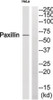 Western blot analysis of extracts from HeLa and JK using Paxillin (Phospho-Ser272) Antibody. The lane on the right is treated with the antigen-specific peptide.
