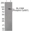 Western blot analysis of extracts from COS7 cells (Lane 2) , using BL-CAM (Phospho-Tyr807) Antibody. The lane on the left is treated with antigen-specific peptide.