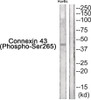 Western blot analysis of extracts from HuvEc cells using Connexin 43 (Phospho-Ser265) Antibody. The lane on the right is treated with the antigen-specific peptide.