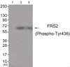 Western blot analysis of extracts from HuvEc cells (Lane 2) and JK cells (Lane 3) , using FRS2 (Phospho-Tyr436) Antibody. The lane on the left is treated with antigen-specific peptide.