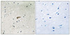 Immunohistochemical analysis of paraffin-embedded human brain tissue using FRS2 (Phospho-Tyr436) antibody (left) or the same antibody preincubated with blocking peptide (right) .