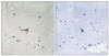 Immunohistochemical analysis of paraffin-embedded human brain tissue using DDR1 (Phospho-Tyr513) antibody (left) or the same antibody preincubated with blocking peptide (right) .