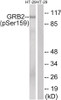 Western blot analysis of extracts from HT-29 cells treated with serum using GRB2 (Phospho-Ser159) Antibody. The lane on the right is treated with the antigen-specific peptide.