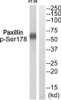 Western blot analysis of extracts from HT-29 using Paxillin (Phospho-Ser178) Antibody. The lane on the right is treated with the antigen-specific peptide.