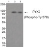Western blot analysis of extracts from 3T3 cells (Lane 2) and HepG2 cells (Lane 3) , using PYK2 (Phospho-Tyr579) Antibody. The lane on the left is treated with antigen-specific peptide.
