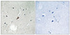 Immunohistochemical analysis of paraffin-embedded human brain tissue using PYK2 (Phospho-Tyr579) antibody (left) or the same antibody preincubated with blocking peptide (right) .