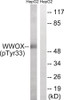 Western blot analysis of extracts from HepG2 cells treated with PMA using WWOX (Phospho-Tyr33) Antibody. The lane on the right is treated with the antigen-specific peptide.