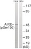 Western blot analysis of extracts from HeLa cells treated with Hu using AIRE (Phospho-Ser156) Antibody. The lane on the right is treated with the antigen-specific peptide.