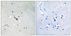 Immunohistochemical analysis of paraffin-embedded human brain tissue using APLP2 (Phospho-Tyr755) antibody (left) or the same antibody preincubated with blocking peptide (right) .