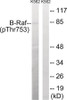 Western blot analysis of extracts from K562 cells treated with EGF using B-Raf (Phospho-Thr753) Antibody. The lane on the right is treated with the antigen-specific peptide.