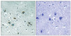 Immunohistochemical analysis of paraffin-embedded human brain tissue using CRMP-2 (Phospho-Thr509) antibody (left) or the same antibody preincubated with blocking peptide (right) .