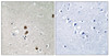 Immunohistochemical analysis of paraffin-embedded human brain tissue, using CtBP1 (Phospho-Ser422) antibody (left) or the same antibody preincubated with blocking peptide (right) .