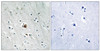 Immunohistochemical analysis of paraffin-embedded human brain tissue using MAPKAPK2 (Phospho-Ser272) antibody (left) or the same antibody preincubated with blocking peptide (right) .