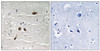 Immunohistochemical analysis of paraffin-embedded human brain tissue using MDC1 (Phospho-Ser513) antibody (left) or the same antibody preincubated with blocking peptide (right) .