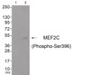 Western blot analysis of extracts from cos-7 cells (Lane 2) , using MEF2C (Phospho-Ser396) Antibody. The lane on the left is treated with antigen-specific peptide.