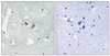 Immunohistochemical analysis of paraffin-embedded human brain tissue using p47 phox (Phospho-Ser345) antibody (left) or the same antibody preincubated with blocking peptide (right) .