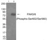 Western blot analysis of extracts from HeLa cells (Lane 2) , using PAK5/6 (Phospho-Ser602/Ser560) Antibody. The lane on the left is treated with antigen-specific peptide.