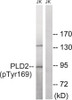 Western blot analysis of extracts from Jurkat cells treated with TNF using PLD2 (Phospho-Tyr169) Antibody. The lane on the right is treated with the antigen-specific peptide.
